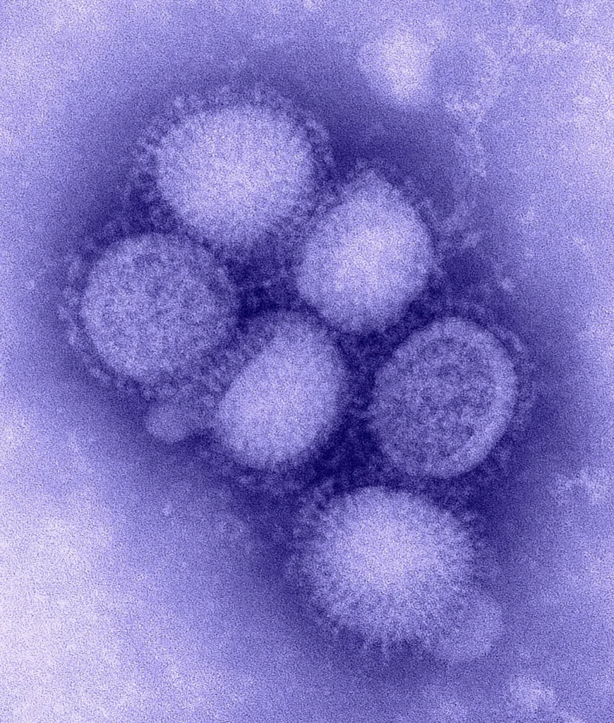 CDCの研究所で撮影されたH1N1インフルエンザウイルス