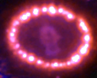 宇宙空間に広がる超新星SN 1987Aの環状構造